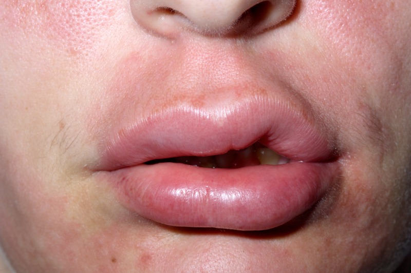 CK_pc004356962.jpg