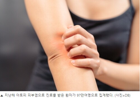 알레르기 뉴스