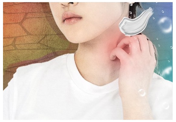 알레르기 뉴스