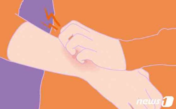 알레르기 뉴스