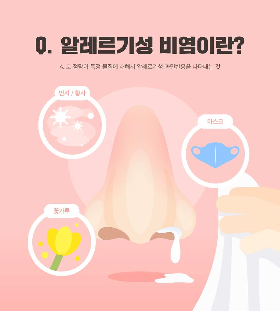 알레르기 뉴스