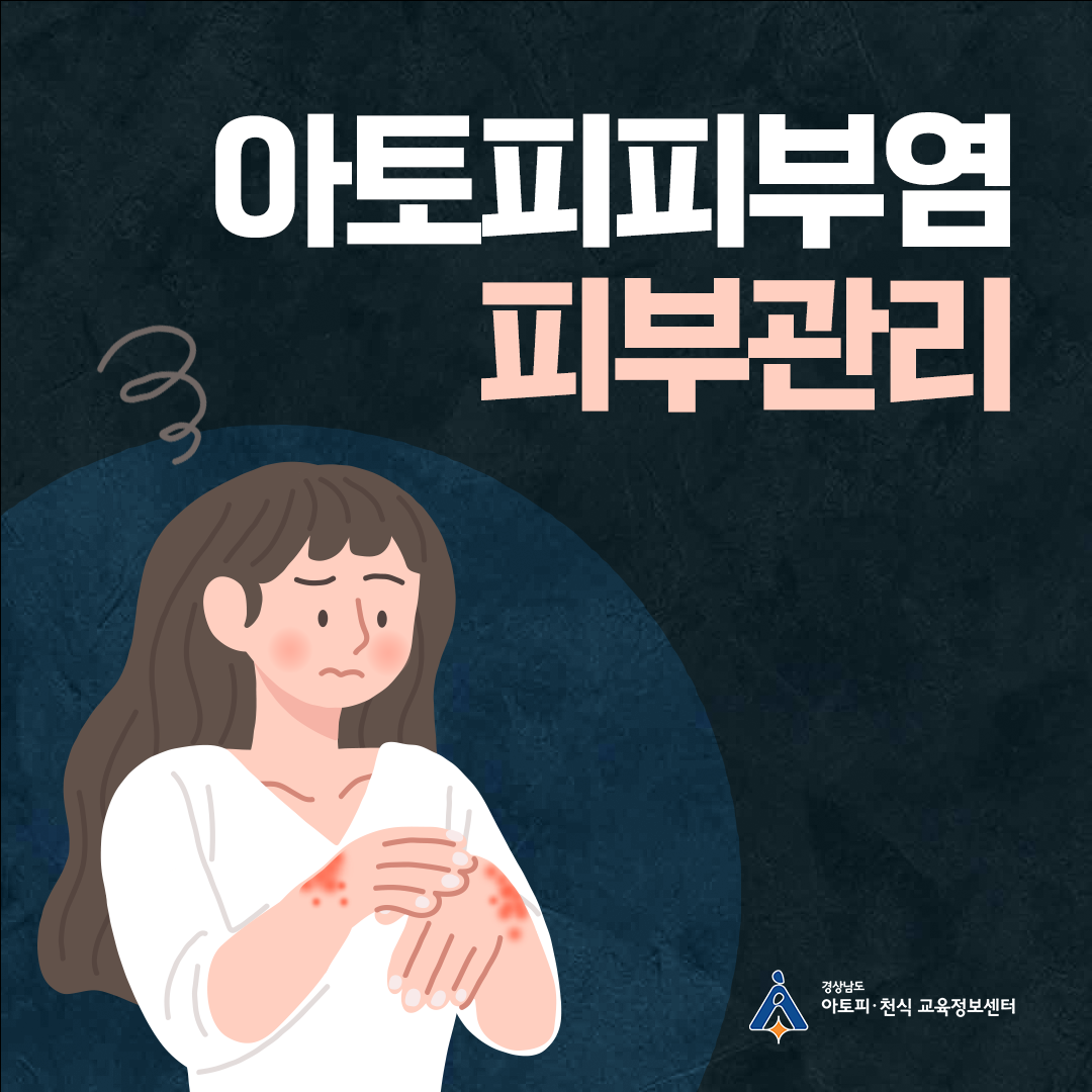 알레르기 뉴스