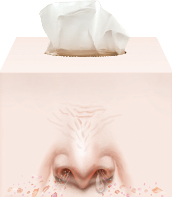 알레르기 뉴스