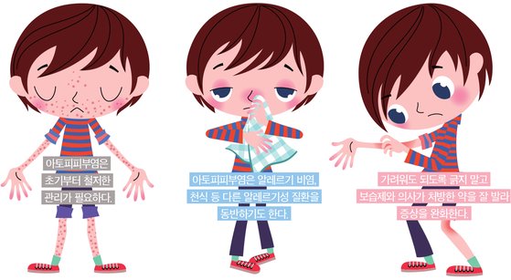 알레르기 뉴스
