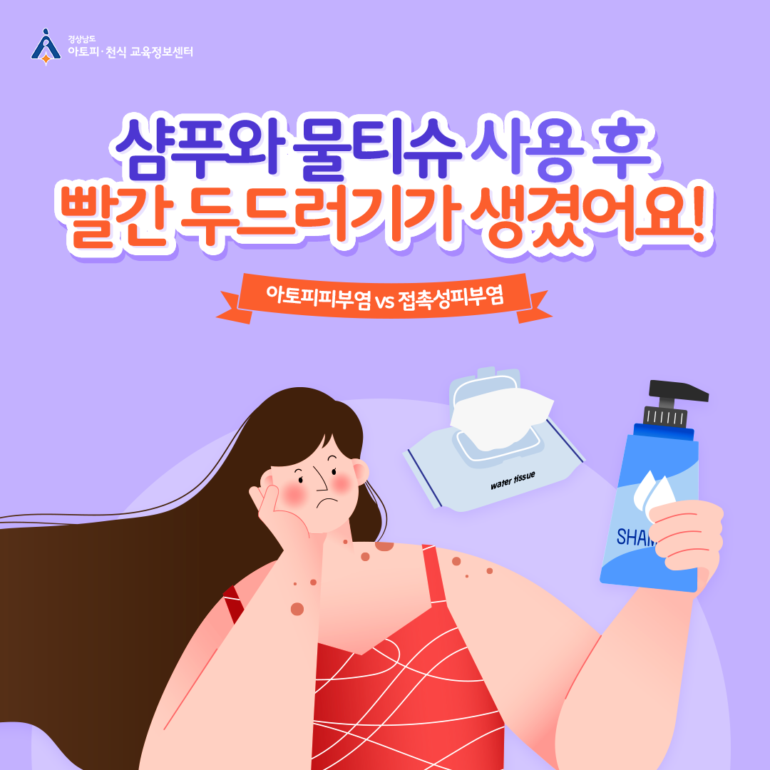 알레르기 뉴스